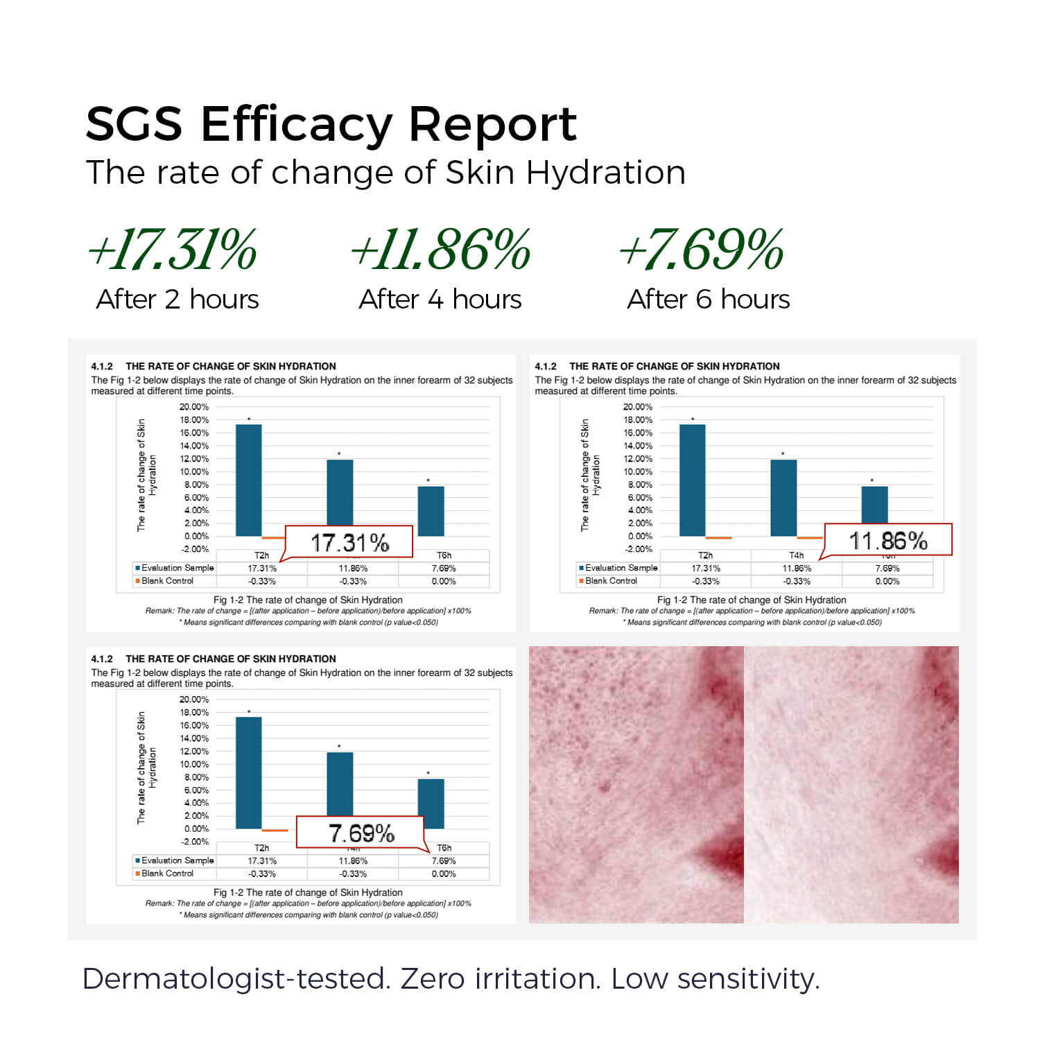 SGS Efficacy Report on skin hydration change with graphs and text.
