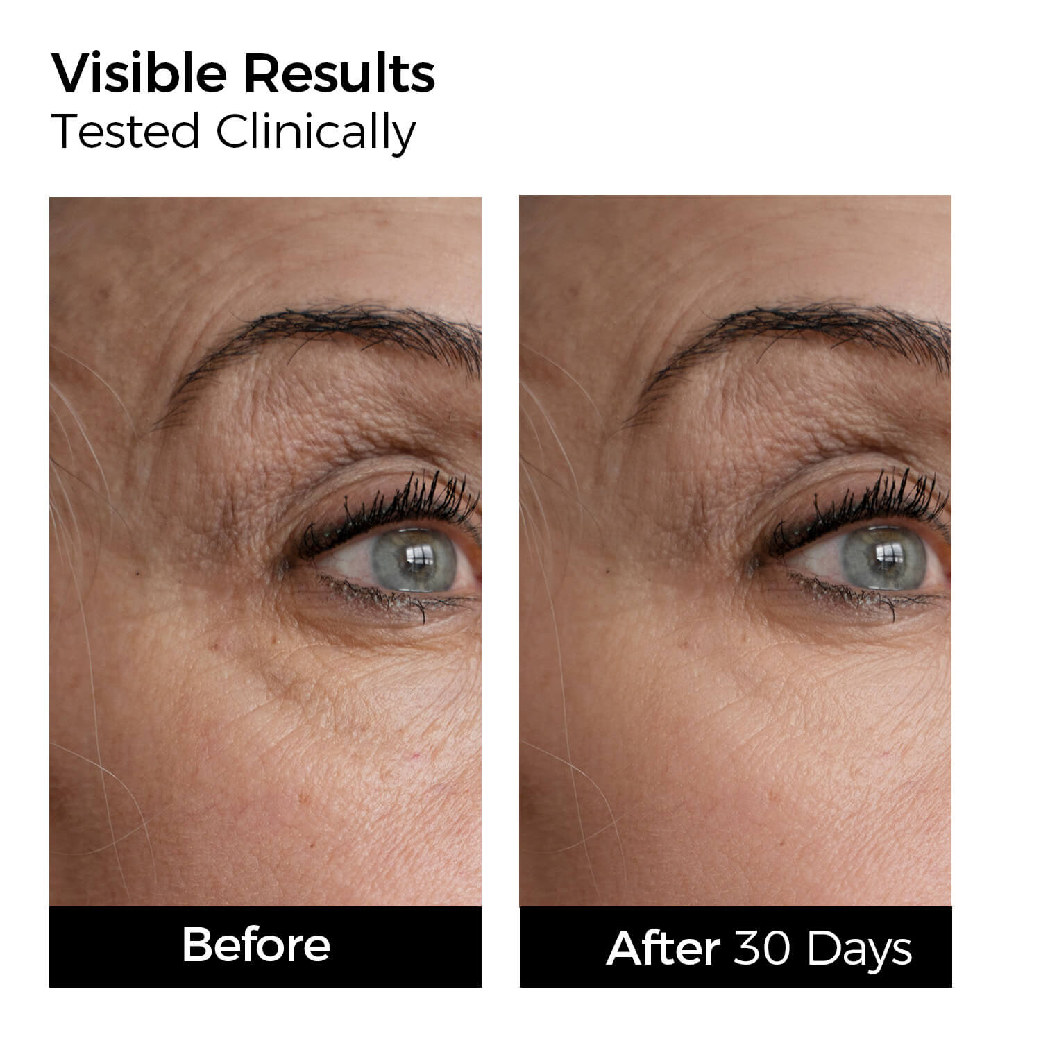 Before and after comparison of eye area with visible skin improvement after 30 days.