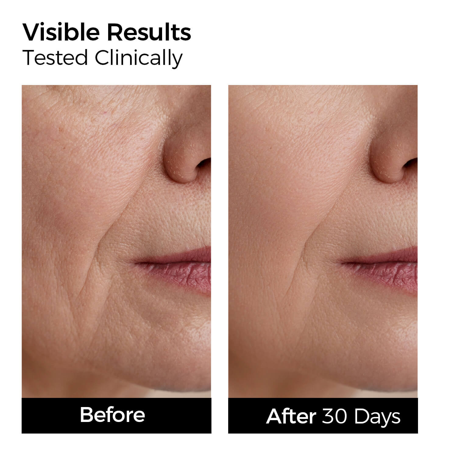 Before and after comparison of skin texture on a person's face with text indicating clinical testing and results after 30 days.
