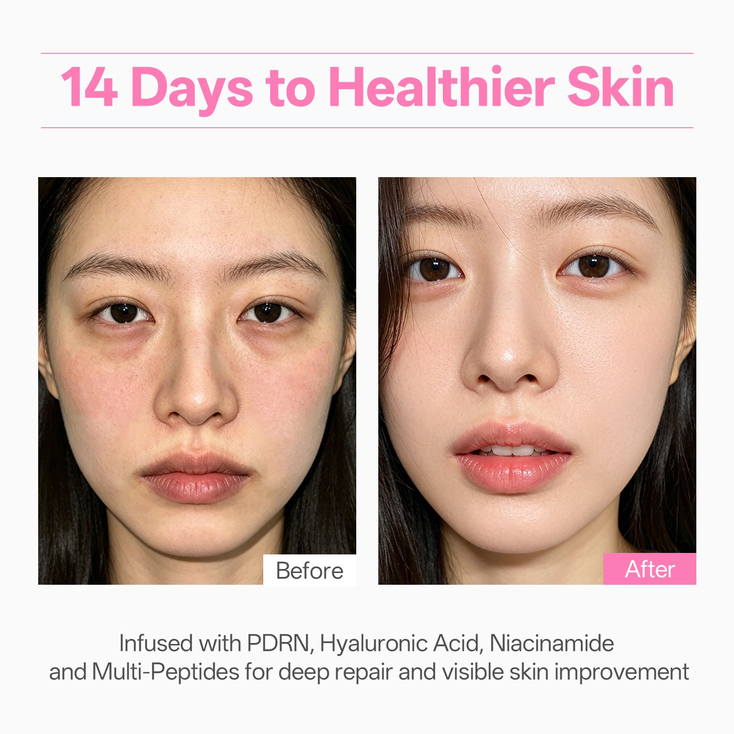 Rose PDRN Glow Highlight Cream