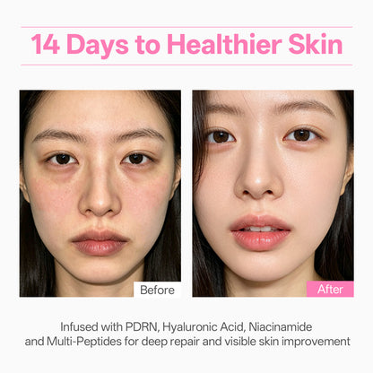 Rose PDRN Glow Highlight Cream