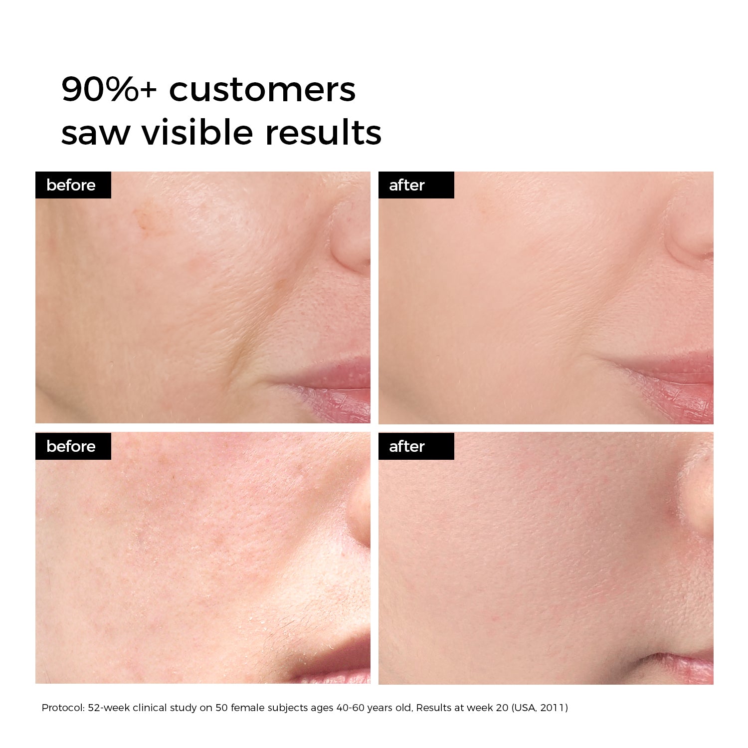 WNP Deep Hydration Hyaluronic Skincare Set
