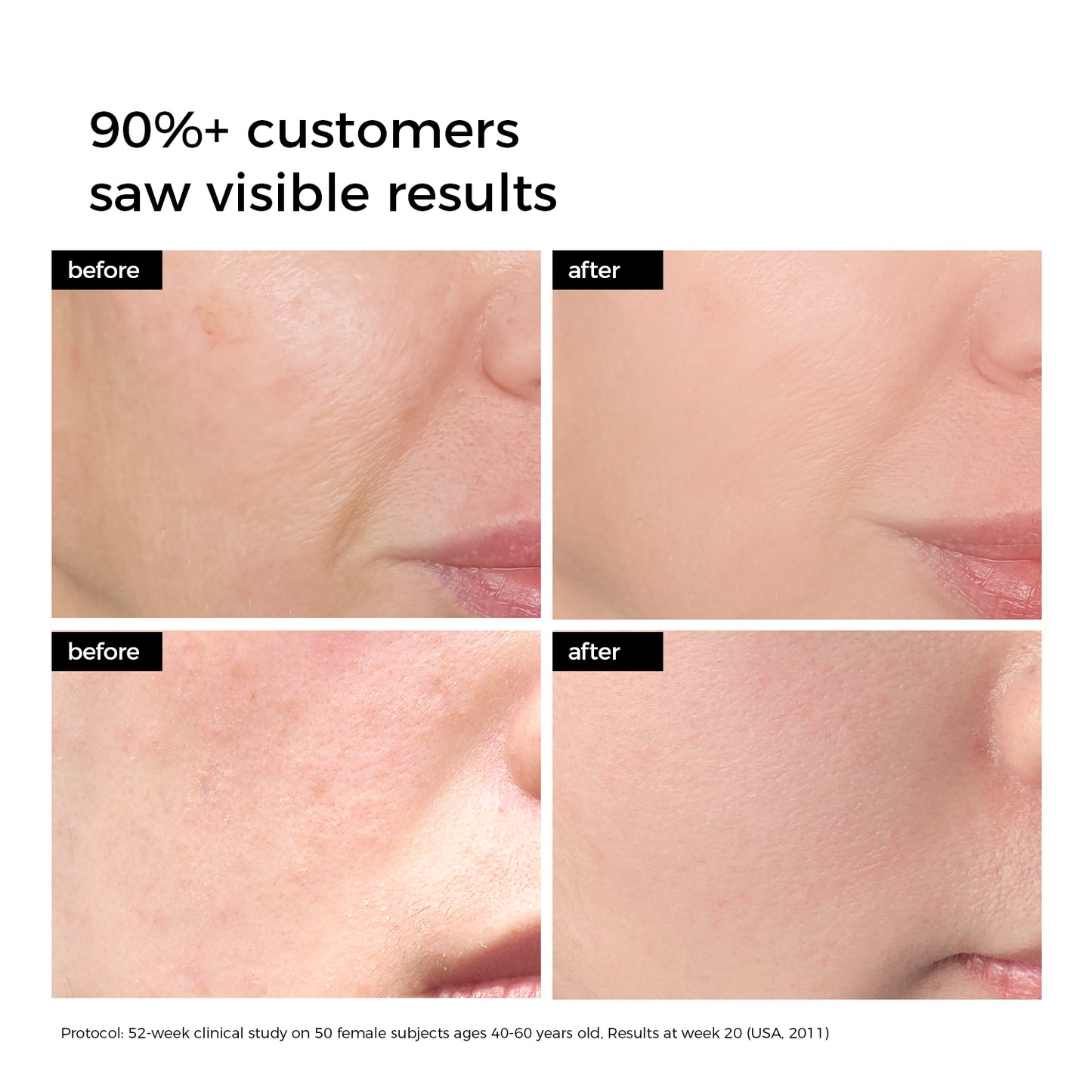 Deep Hydration Hyaluronic Skincare Set