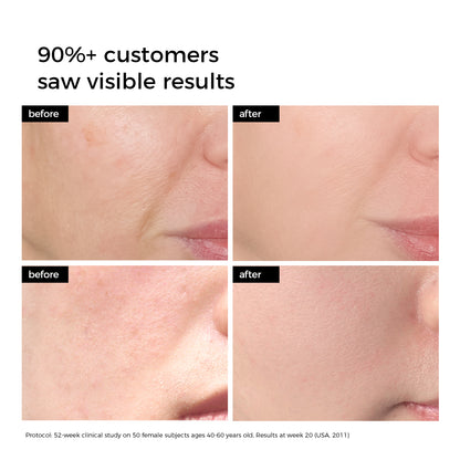 Deep Hydration Hyaluronic Skincare Set