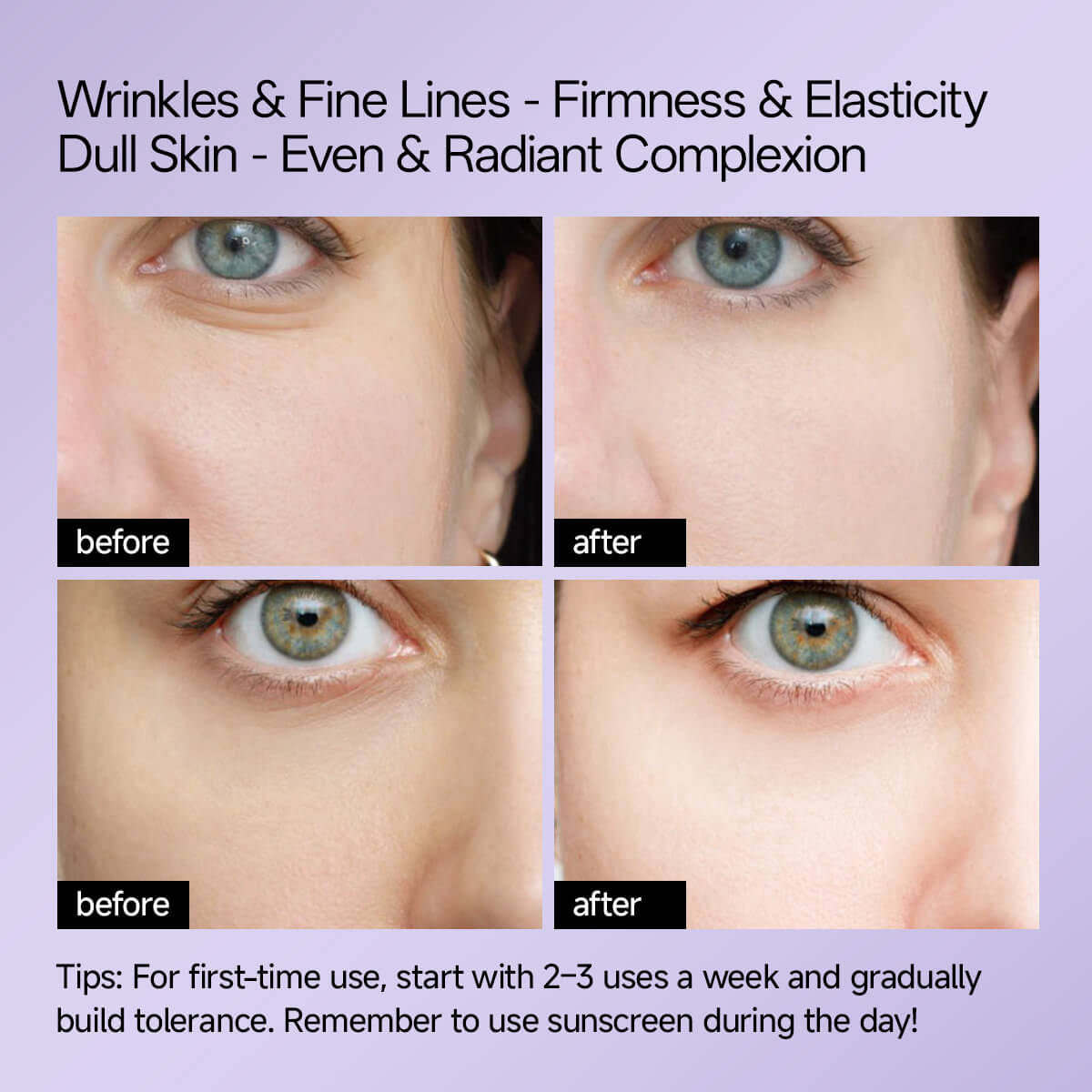 Before and after comparison of wrinkles, fine lines, firmness, and elasticity on a person's face with text on a purple background.