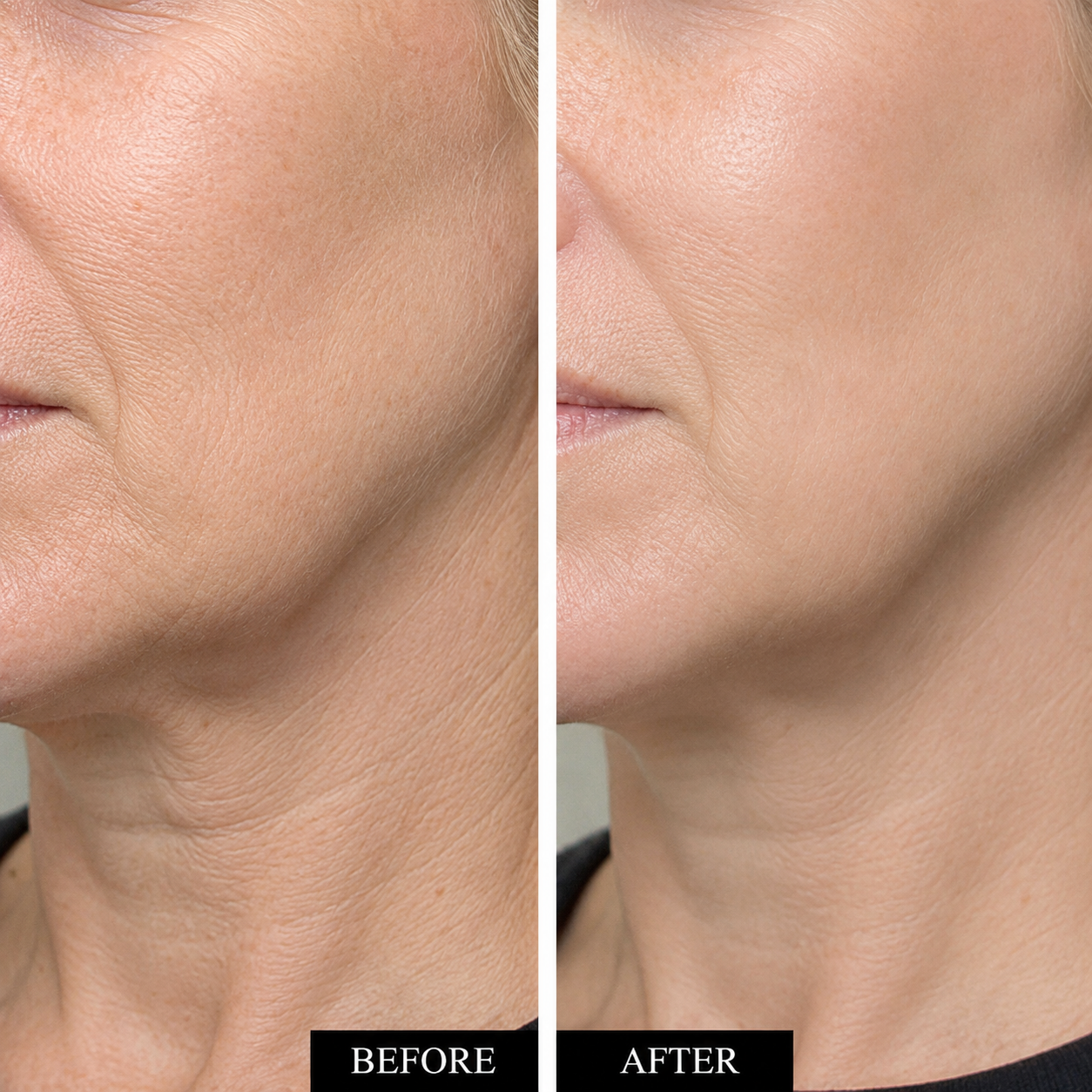 3% Hyaluronic Acid and Emergency Repair Serum Set