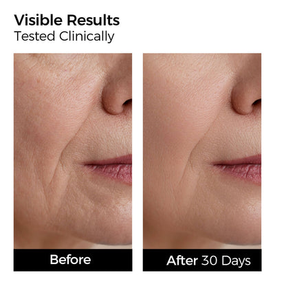 Before and after comparison of skin texture on a person's face with text indicating clinical testing and results after 30 days.